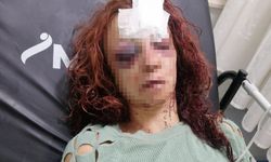 MERSİN - Kız arkadaşını bıçakla ve darbederek yaralayan zanlı ile arkadaşı tutuklandı